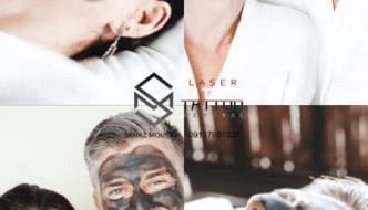 carbon laser peel